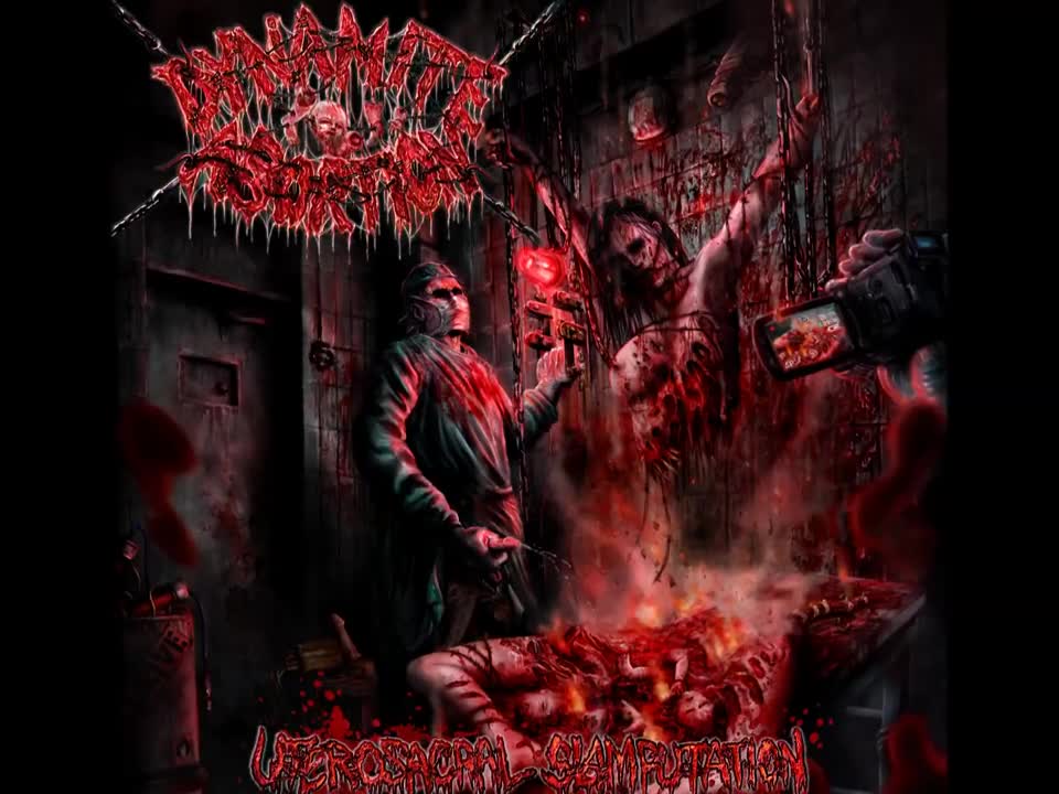 Dynamite Abortion - Introducing the Cranioclast